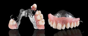 treatments-partialdenture-feature Partial dentures