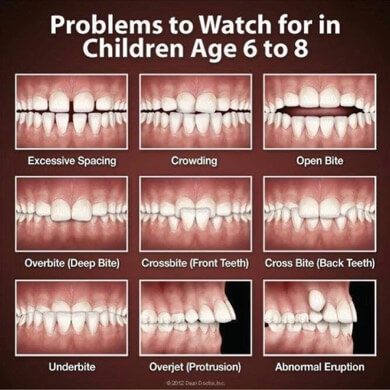 Children Teeth Problems