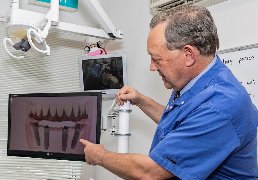 Dental implants, new teeth on 4, dental implant dentist pointing at diagram