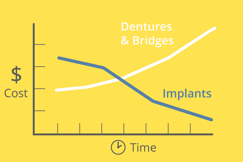 cost of dental implants graph