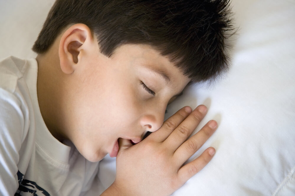 early intervention orthodontics, thumb sucking