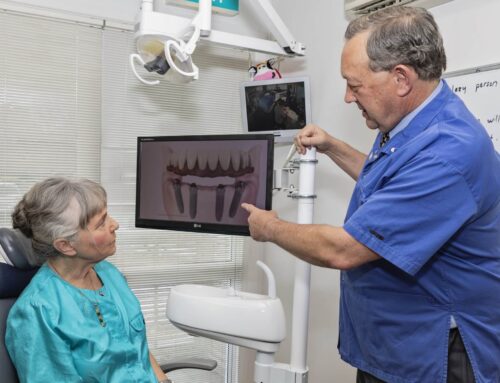 What To Ask Before Getting A Dental Implant