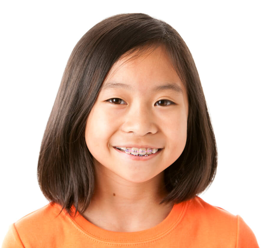 orthodontics for kids