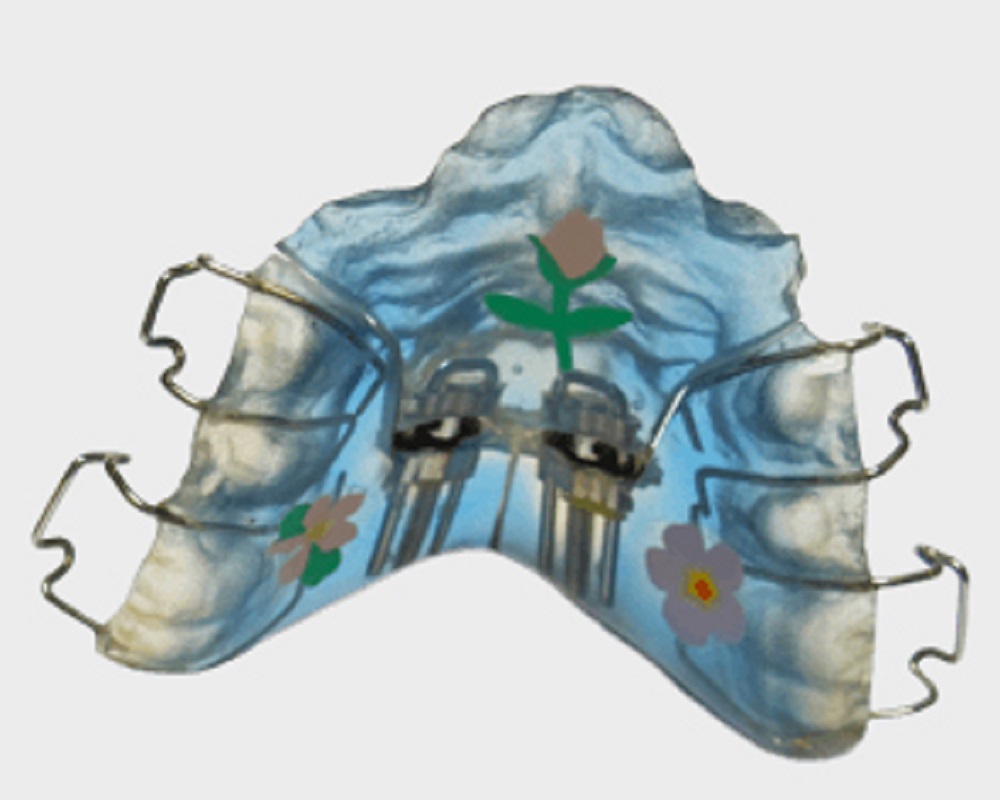 orthodontics-removable-appliance-post02