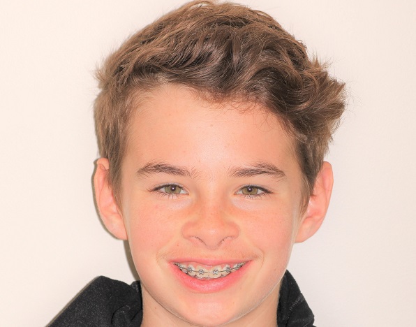 Logan Taylor after pic_resized