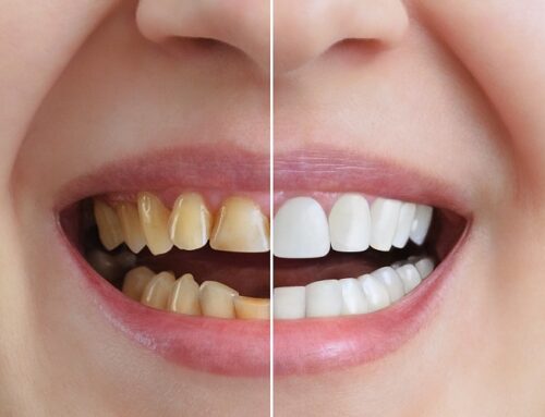 Get Ready to Smile: How Cosmetic Dentistry Can Transform Your Life