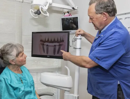 What To Ask Before Getting A Dental Implant